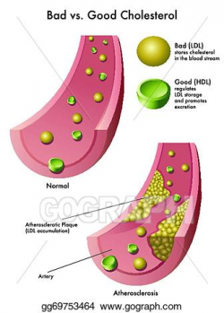 EPS Vector - Cholesterol. Stock Clipart Illustration ...