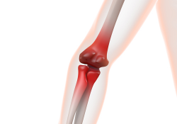 Free Joint Pain Cliparts, Download Free Clip Art, Free Clip ...