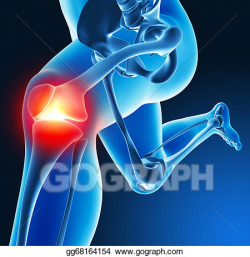 Stock Illustration - Leg joint pain. Clipart gg68164154 ...