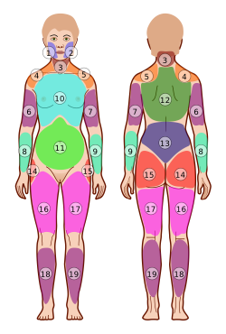 File:Widespread Pain Index Areas with numbers.svg - Wikimedia Commons