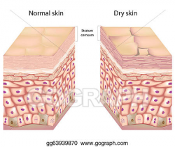 Vector Clipart - Dry skin, eps8. Vector Illustration ...