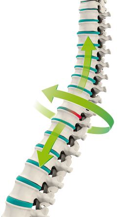 Robotic ATT – Spine Therapy | doclifecare GmbH