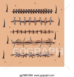Vector Stock - Stitches. Clipart Illustration gg78891969 ...