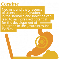 Gastrointestinal Condition: What Substance Abuse Does to the Body