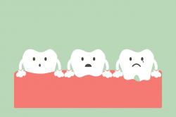 Causes and Treatments for Receding Gums - Flintlock Dental