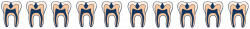 Fluoride Teeth | Fluoride Exposed