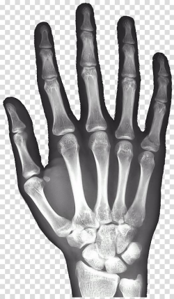 X-ray of hand bone clipa rt, X-ray Hand Carpal bones Android ...